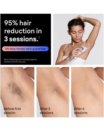 Braun Smart IPL Skin I expert, Free App 4 Smart Heads PL7441