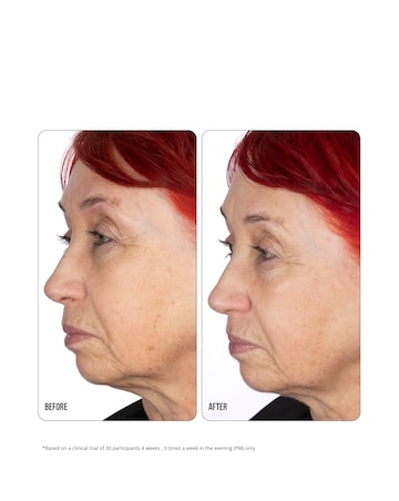 NIP+FAB Retinol Fix Concentrate Extreme 10% - 30ml