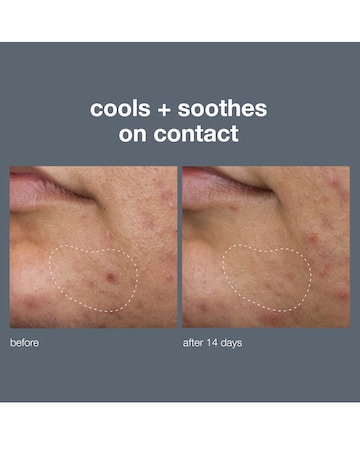 Dermalogica Deep Breakout Liquid Patch