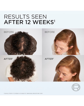 L'Oreal Paris Elvive Growth Booster Shampoo 200ml