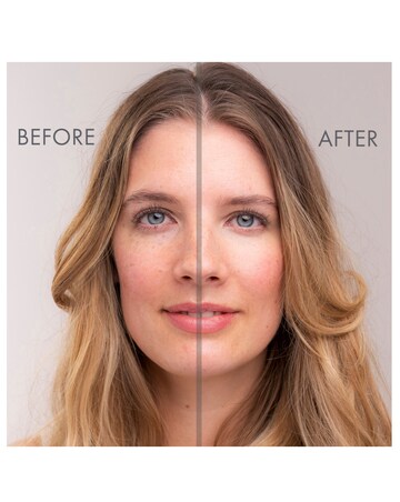 Gatineau Miracle Eye Contour Cream - 11ml