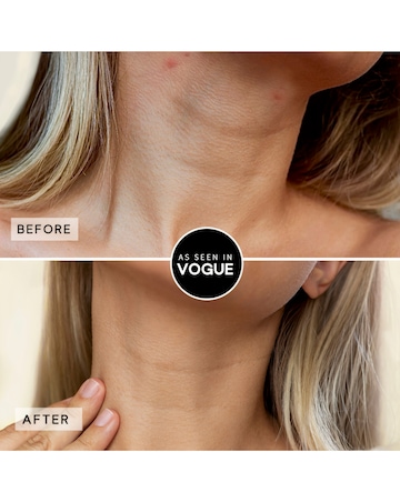 Sensse LED Neck Mask