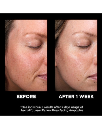 L'Oreal Paris Revitalift Laser Ampoules 10% Glycolic Acid Peel 7x1ml