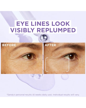 L'Oreal Paris 2.5 Hyaluronic Acid and Caffeine Eye Serum 20ml