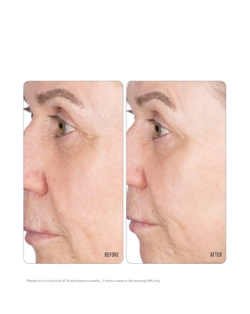 NIP+FAB Retinol Fix Concentrate Extreme 10% - 30ml