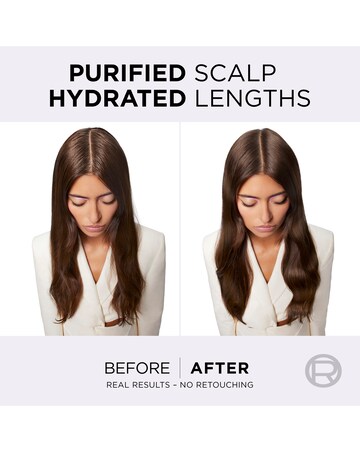 L'Oreal Paris Elvive Hydra Pure Exfoliating Pre-Shampoo Scalp Serum