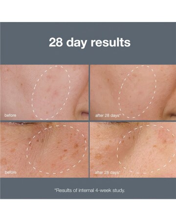 Dermalogica PowerBright Dark Spot System kit