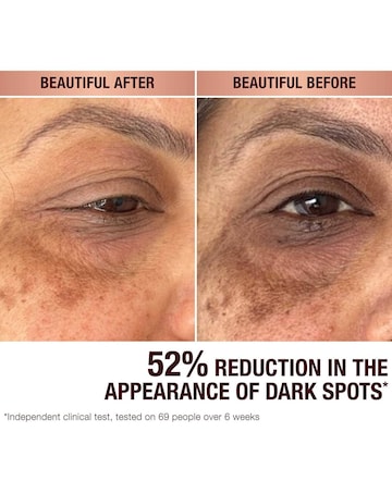 Charlotte Tilbury Dark Spot Correcting Radiance Recovery Serum 30ml
