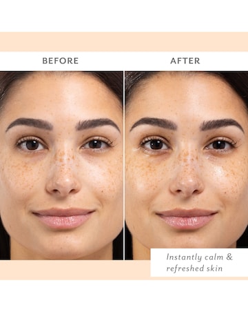 Patchology Skin Remedy Calm & Protect Mist