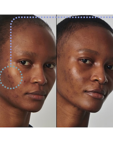 The INKEY Oil Solution Niacinamide Serum